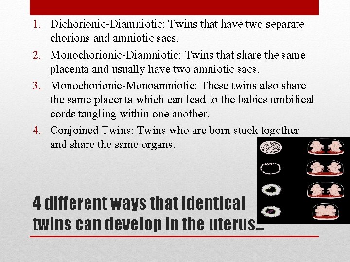 1. Dichorionic-Diamniotic: Twins that have two separate chorions and amniotic sacs. 2. Monochorionic-Diamniotic: Twins