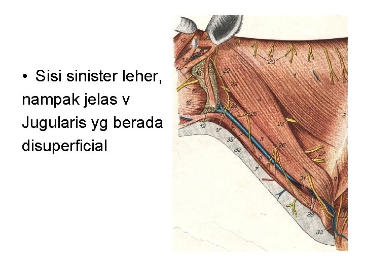  • Sisi sinister leher, nampak jelas v Jugularis yg berada disuperficial 