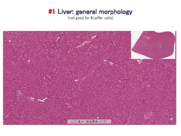 #1 Liver: general morphology (not good for Kupffer cells) 