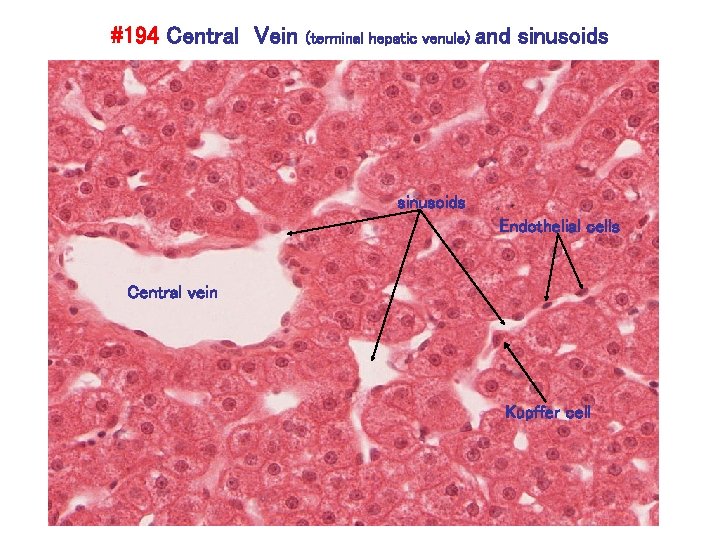 #194 Central Vein (terminal hepatic venule) and sinusoids Endothelial cells Central vein Kupffer cell