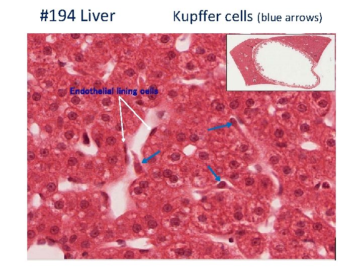 #194 Liver Endothelial lining cells Kupffer cells (blue arrows) 