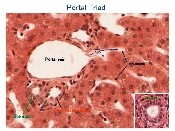 Portal Triad Portal vein sinusoids Bile duct br. of hepatic artery Bile duct 