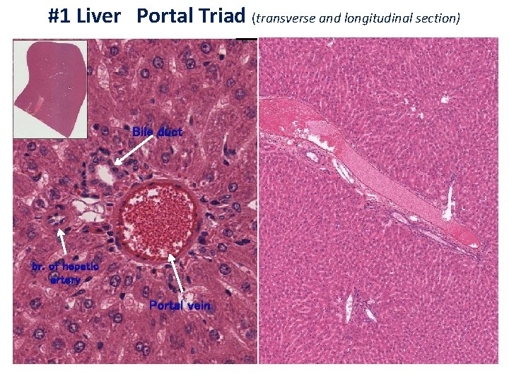 #1 Liver Portal Triad (transverse and longitudinal section) Bile duct br. of hepatic artery
