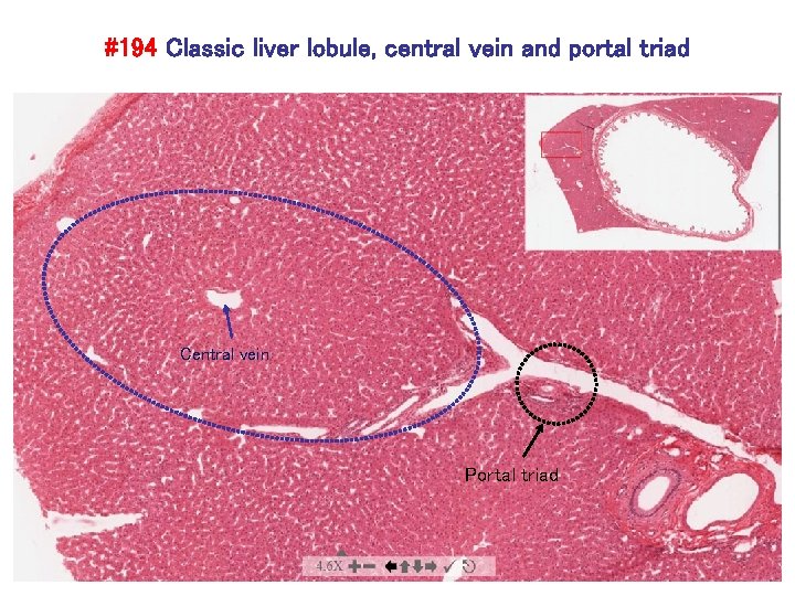 #194 Classic liver lobule, central vein and portal triad Central vein Portal triad 