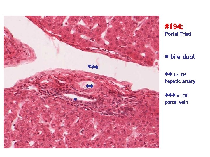 #194: Portal Triad * bile duct *** ** br. Of hepatic artery ***br. Of
