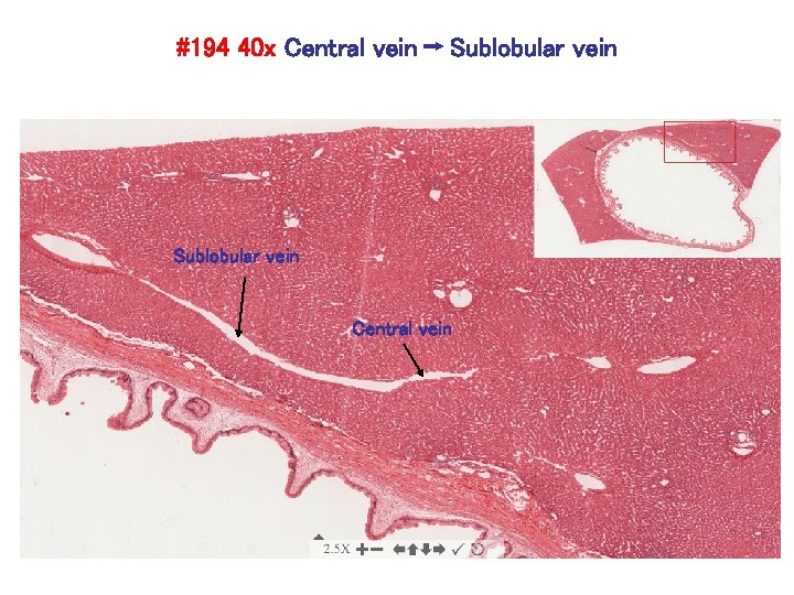 #194 40 x Central vein Sublobular vein Central vein 