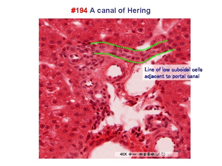 #194 A canal of Hering Line of low cuboidal cells adjacent to portal canal