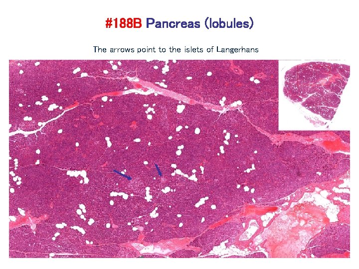 #188 B Pancreas (lobules) The arrows point to the islets of Langerhans 