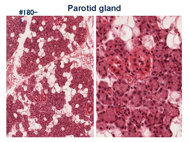 #1801 Parotid gland 
