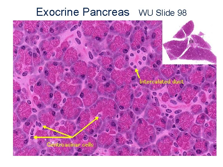 Exocrine Pancreas WU Slide 98 Intercalated duct Centroacinar cells 