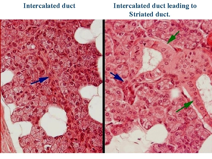 Intercalated duct leading to Striated duct. 