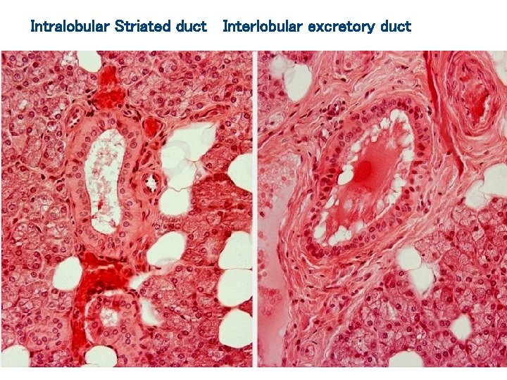 Intralobular Striated duct Interlobular excretory duct 