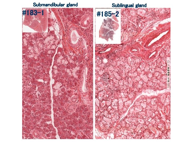 Submandibular gland #183 -1 Sublingual gland #185 -2 