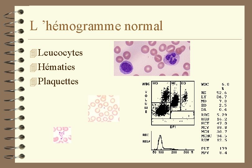 L ’hémogramme normal 4 Leucocytes 4 Hématies 4 Plaquettes 