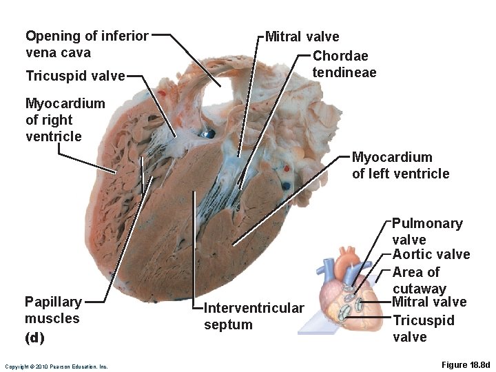 Opening of inferior vena cava Tricuspid valve Mitral valve Chordae tendineae Myocardium of right