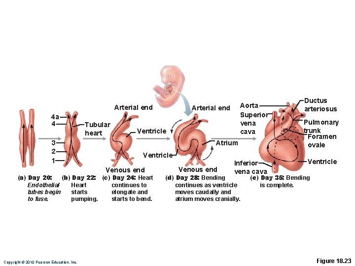 Arterial end 4 a 4 3 2 1 Tubular heart Arterial end Ventricle Atrium