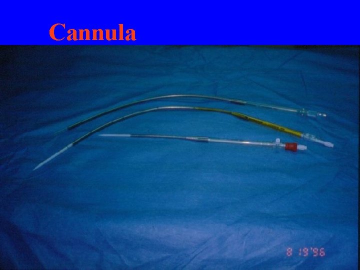 Cannula 