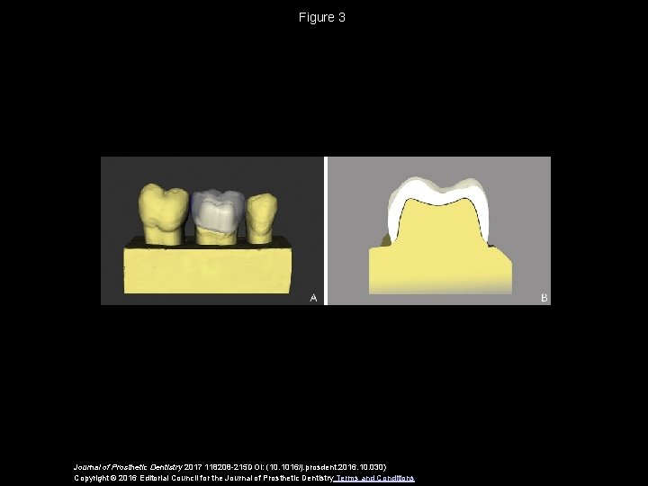 Figure 3 Journal of Prosthetic Dentistry 2017 118208 -215 DOI: (10. 1016/j. prosdent. 2016.