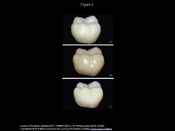 Figure 4 Journal of Prosthetic Dentistry 2017 118208 -215 DOI: (10. 1016/j. prosdent. 2016.