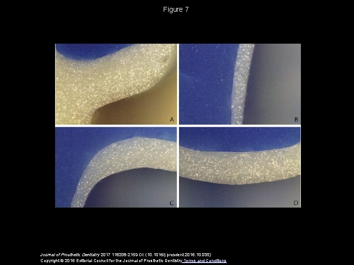 Figure 7 Journal of Prosthetic Dentistry 2017 118208 -215 DOI: (10. 1016/j. prosdent. 2016.