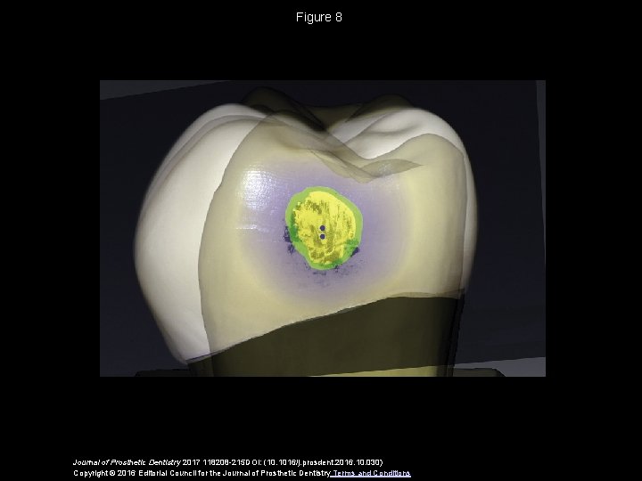 Figure 8 Journal of Prosthetic Dentistry 2017 118208 -215 DOI: (10. 1016/j. prosdent. 2016.