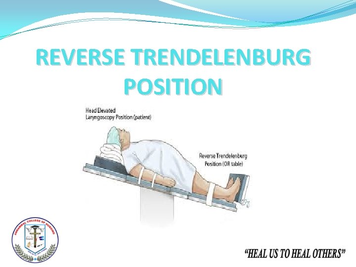 REVERSE TRENDELENBURG POSITION 