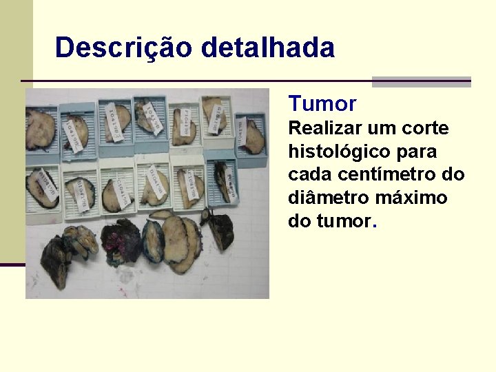 Descrição detalhada n - Tumor Realizar um corte histológico para cada centímetro do diâmetro