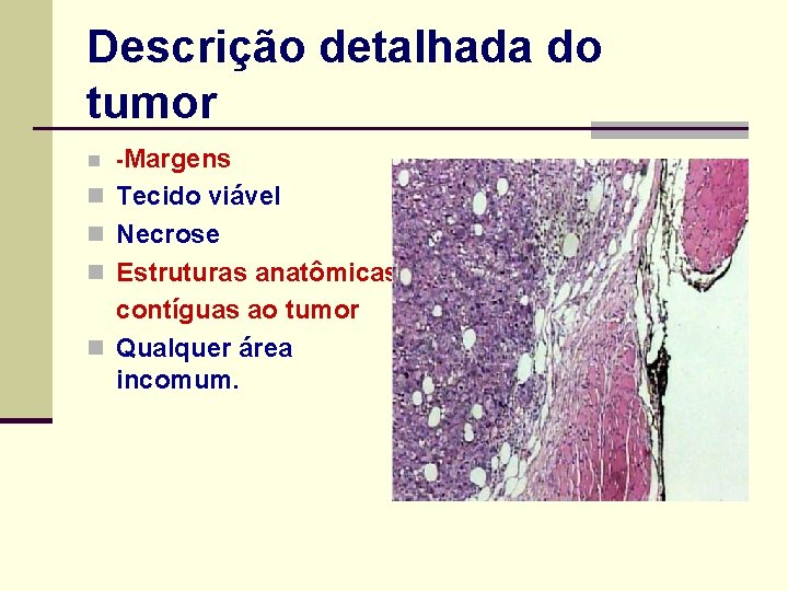 Descrição detalhada do tumor n -Margens n Tecido viável n Necrose n Estruturas anatômicas