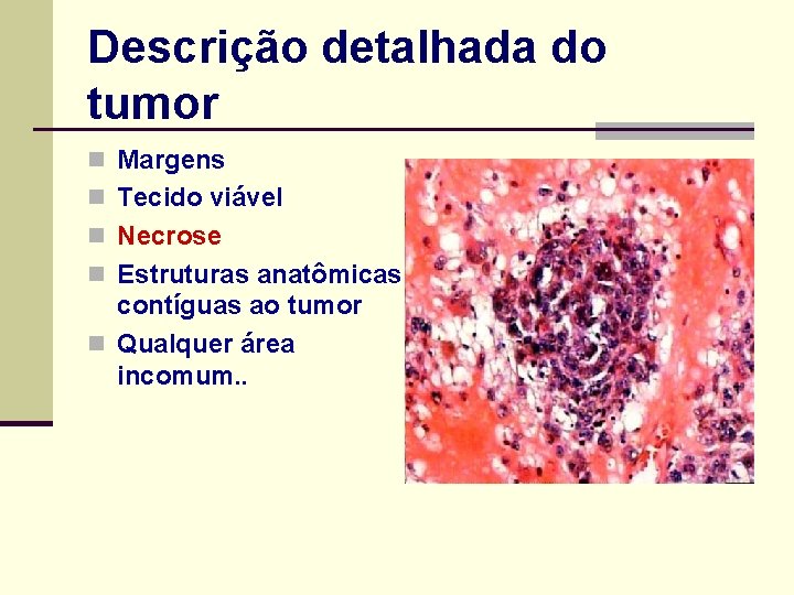 Descrição detalhada do tumor n Margens n Tecido viável n Necrose n Estruturas anatômicas
