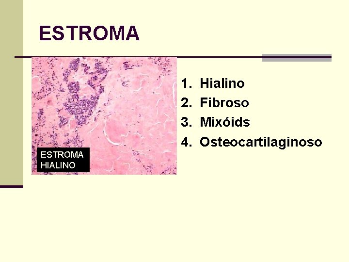 ESTROMA 1. Hialino 2. Fibroso 3. Mixóids 4. Osteocartilaginoso ESTROMA HIALINO 