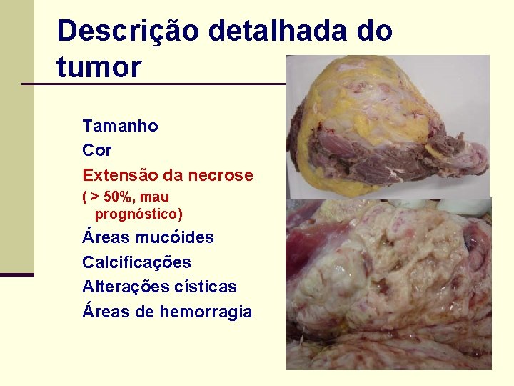 Descrição detalhada do tumor Tamanho Cor Extensão da necrose ( > 50%, mau prognóstico)