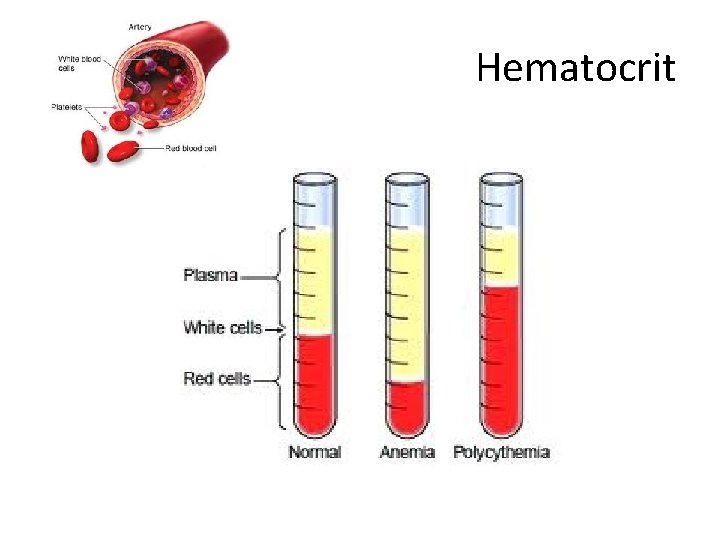Hematocrit 