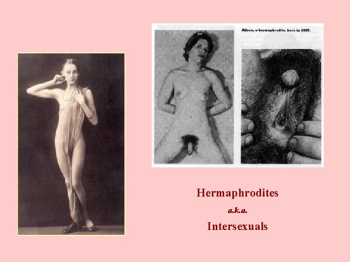 Hermaphrodites a. k. a. Intersexuals 