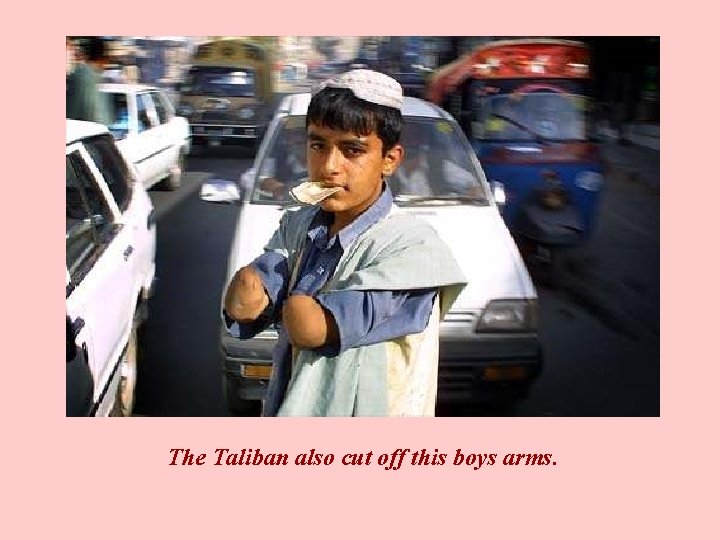 The Taliban also cut off this boys arms. 