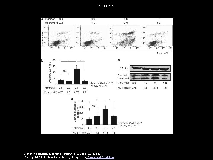 Figure 3 Kidney International 2015 88833 -842 DOI: (10. 1038/ki. 2015. 165) Copyright ©