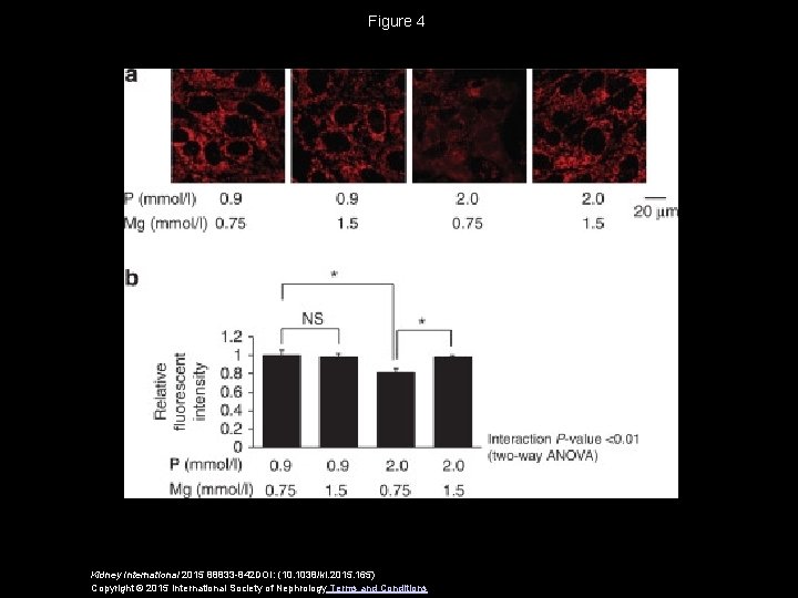 Figure 4 Kidney International 2015 88833 -842 DOI: (10. 1038/ki. 2015. 165) Copyright ©