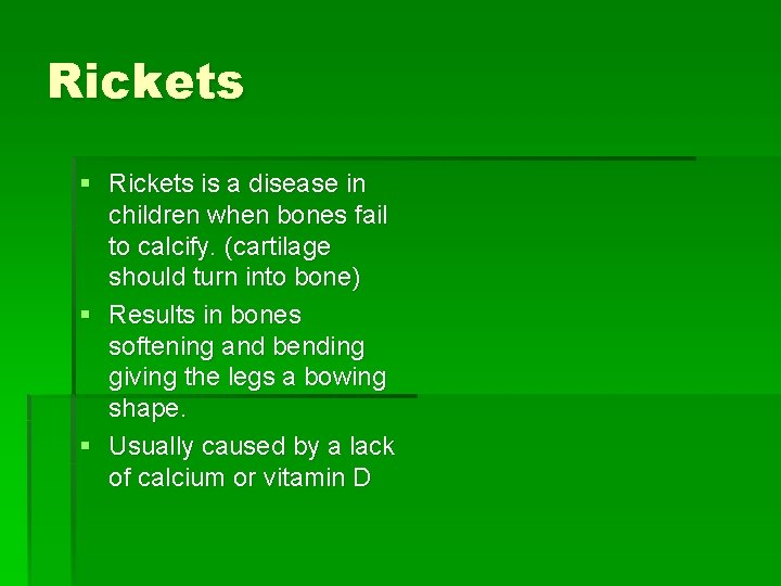 Rickets § Rickets is a disease in children when bones fail to calcify. (cartilage