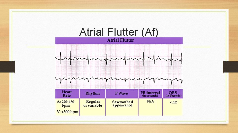 Atrial Flutter (Af) 