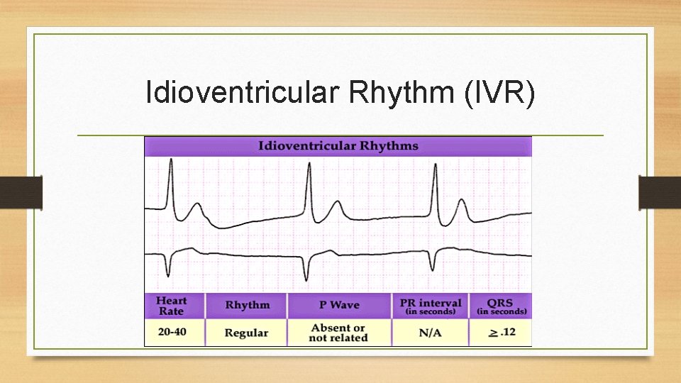 Idioventricular Rhythm (IVR) 
