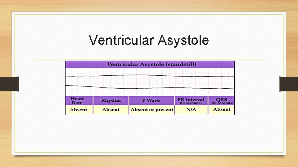 Ventricular Asystole 