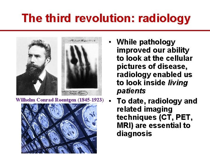The third revolution: radiology Wilhelm Conrad Roentgen (1845 -1923) • While pathology improved our