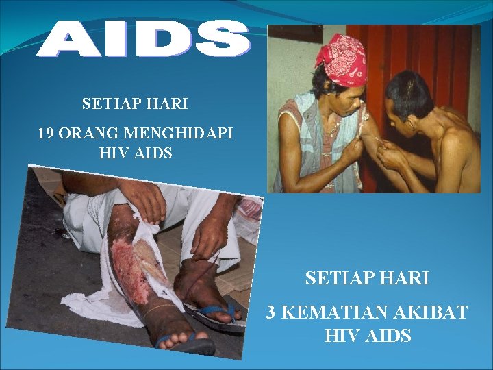 SETIAP HARI 19 ORANG MENGHIDAPI HIV AIDS SETIAP HARI 3 KEMATIAN AKIBAT HIV AIDS