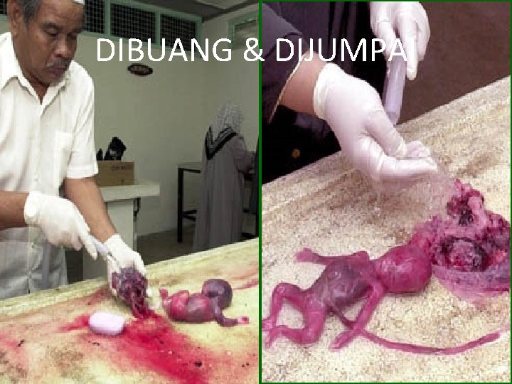 DIBUANG & DIJUMPAI 