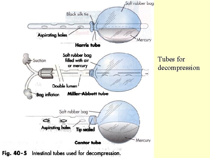 Tubes for decompression 