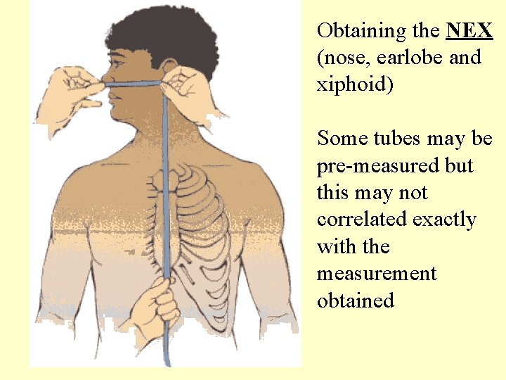 Obtaining the NEX (nose, earlobe and xiphoid) Some tubes may be pre-measured but this