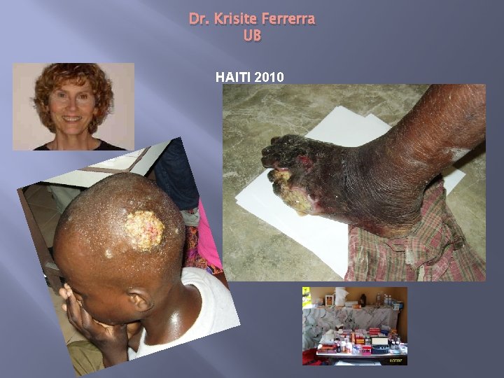 Dr. Krisite Ferrerra UB HAITI 2010 