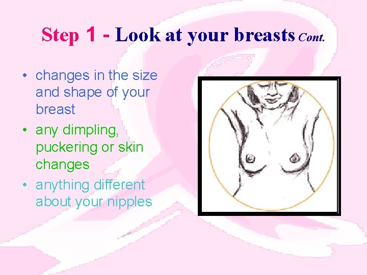 Step 1 - Look at your breasts Cont. • changes in the size and