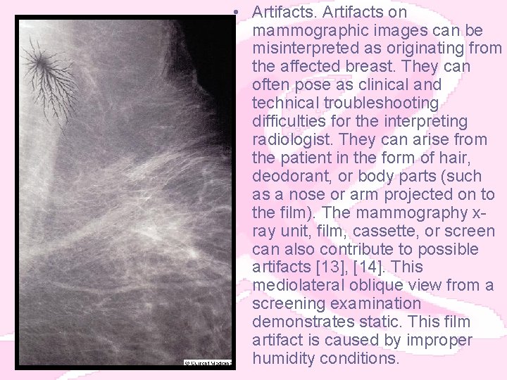  • Artifacts on mammographic images can be misinterpreted as originating from the affected