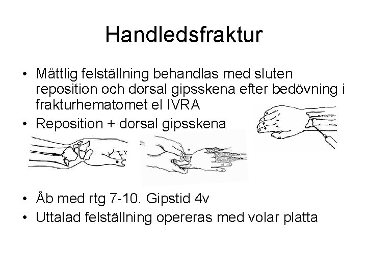 Handledsfraktur • Måttlig felställning behandlas med sluten reposition och dorsal gipsskena efter bedövning i