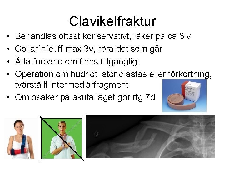 Clavikelfraktur • • Behandlas oftast konservativt, läker på ca 6 v Collar´n´cuff max 3